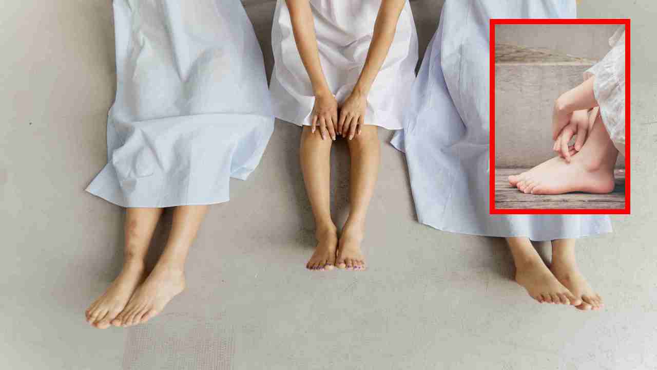 Cracked Feet : చలికాలంలో పాదాల పగుళ్ల సమస్యతో బాధపడుతుంటే ఈ చిట్కాలు పాటించి చూడండి!