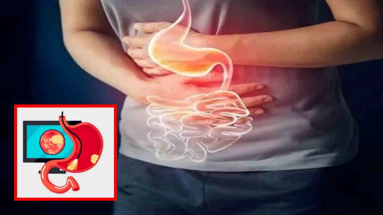 Constipation Problem : మలబద్ధకం సమస్యను దూరం చేసే ఇంటి చిట్కాలు!