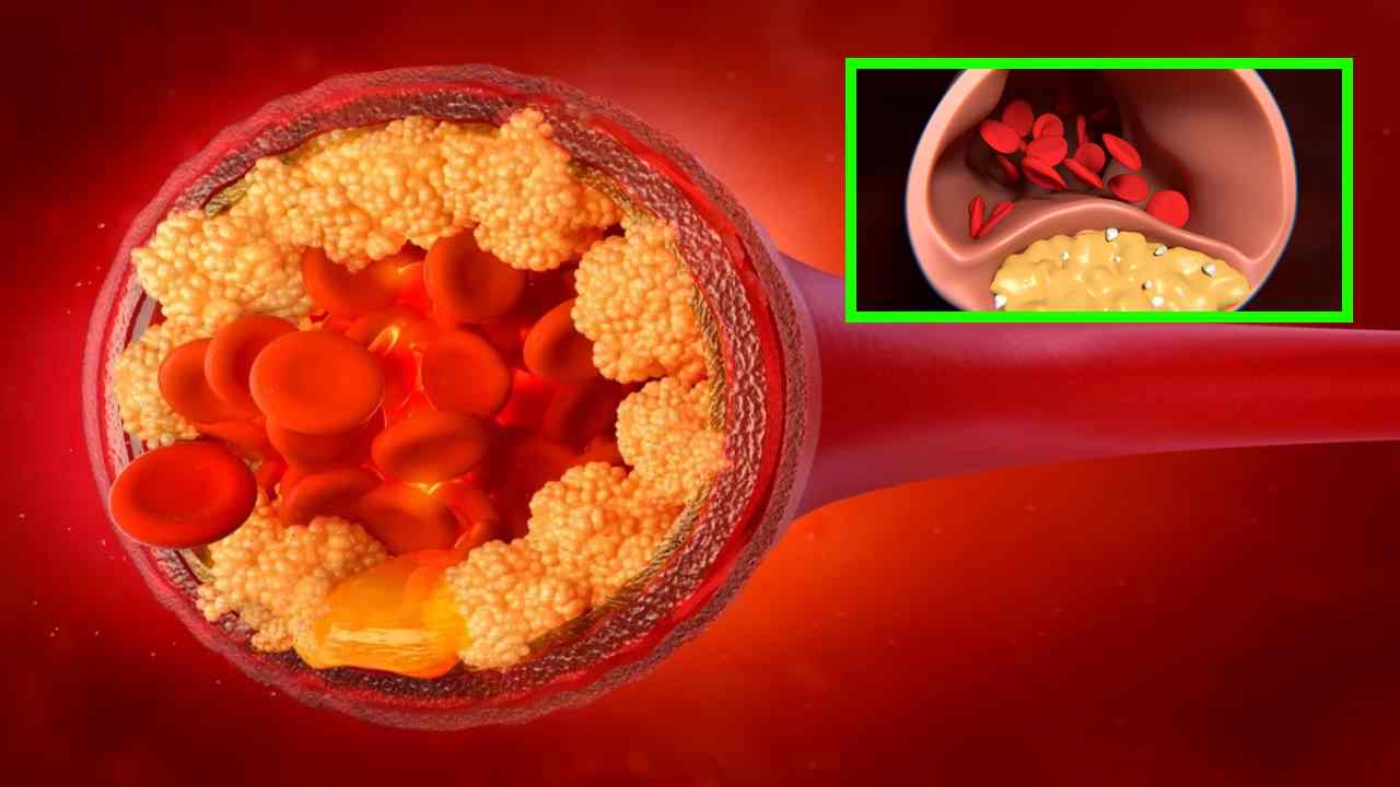 Bad Cholesterol : శరీరంలో చెడు కొలెస్ట్రాల్ తొలగిపోవాలంటే రోజువారిగా ఈ కూరగాయలను ఆహారంలో చేర్చుకోవటం మంచిది!