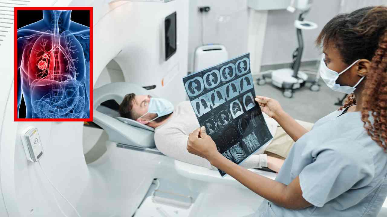 Lung Cancer : ఊపిరితిత్తుల క్యాన్సర్ లక్షణాలు, గుర్తించటంలో దోహదపడే ముందస్తు పరీక్షలు!