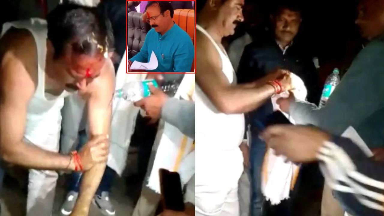 Itching Powder On Minister: ఆ పౌడర్ చల్లిన వ్యక్తి .. కుర్తా విప్పేసి మరీ గోక్కున్న మంత్రి..