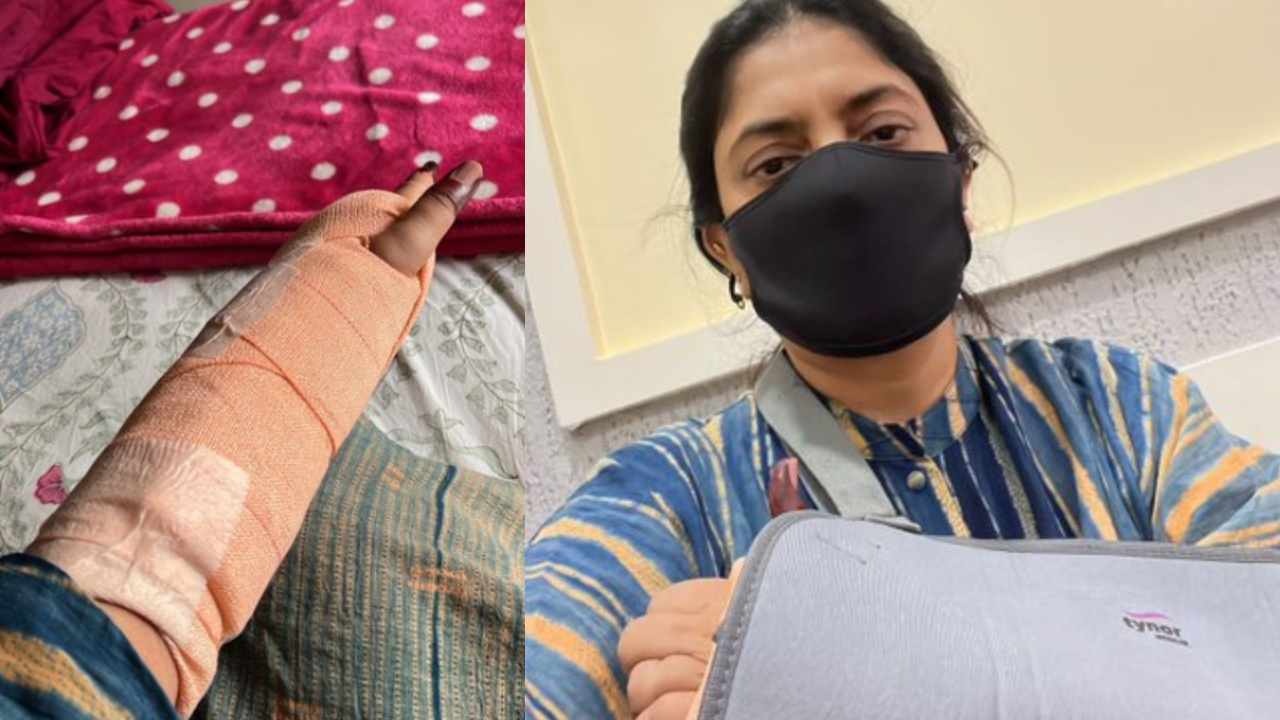 Sudha Kongara : చెయ్యి విరగ్గొట్టుకున్న స్టార్ డైరెక్టర్.. కొని నెలలు ఇంట్లోనే రెస్ట్ మోడ్..