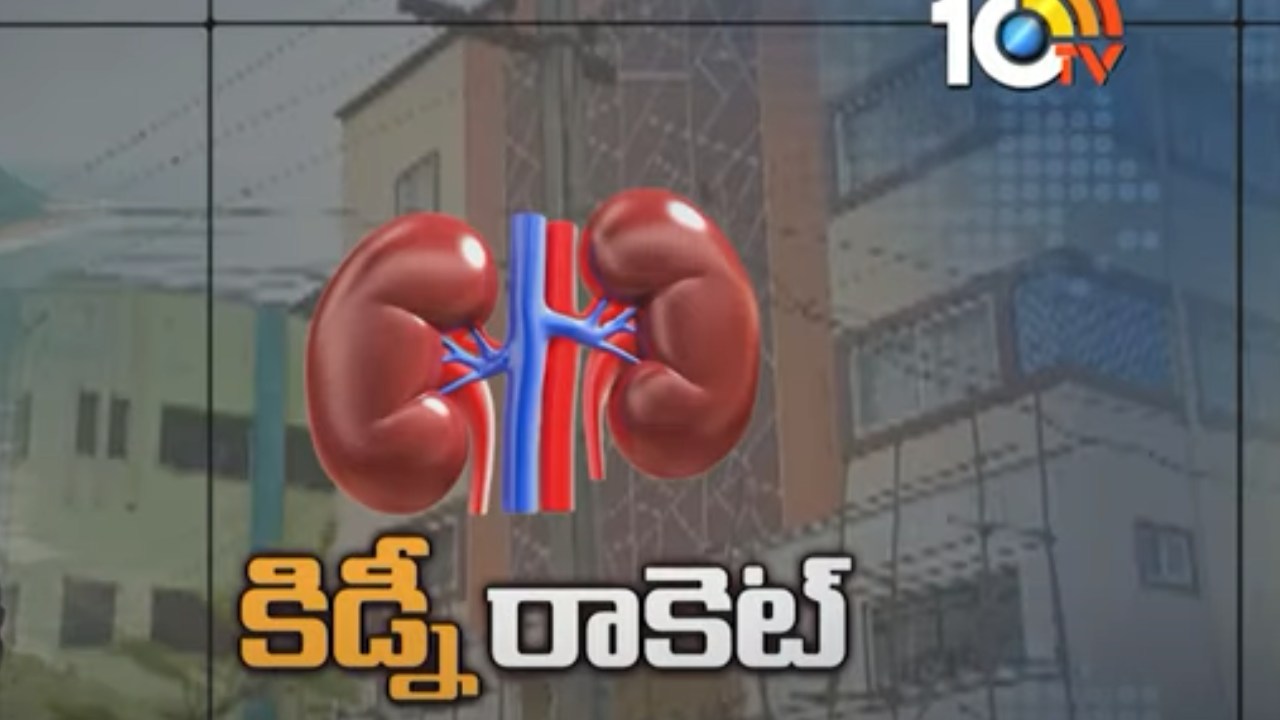 Kidney Racket : విశాఖలో కిడ్నీ రాకెట్ గుట్టురట్టు.. రూ.8,50,000 ఇస్తామంటూ కిడ్నీ తీసుకుని మోసం