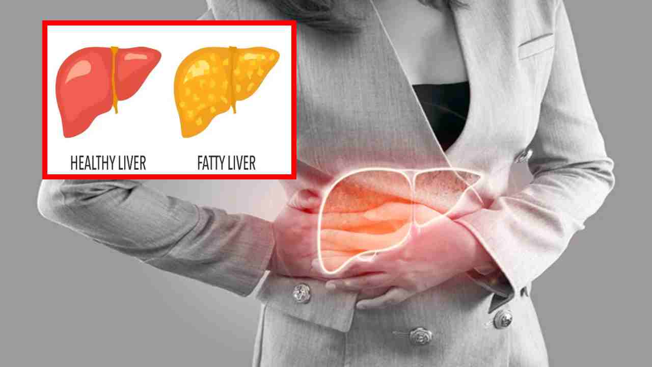 Non-Alcoholic Fatty Liver : ప్రాణాంతకంగా నాన్-ఆల్కహాలిక్ ఫ్యాటీ లివర్ డిసీజ్.. సమస్య నుండి బయటపడేందుకు మార్గాలు