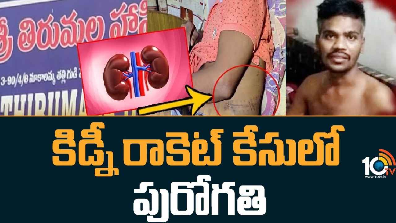 Visakha Kidney Racket Case : విశాఖ కిడ్నీ రాకెట్ కేసులో పురోగతి