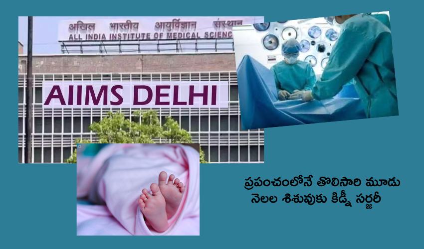 Delhi Aiims : మూడు నెలల పసిబిడ్డకు కిడ్నీ సర్జరీ .. ప్రపంచంలోనే తొలిసారి ఢిల్లీ ఎయిమ్స్ డాక్టర్ల ఘనత