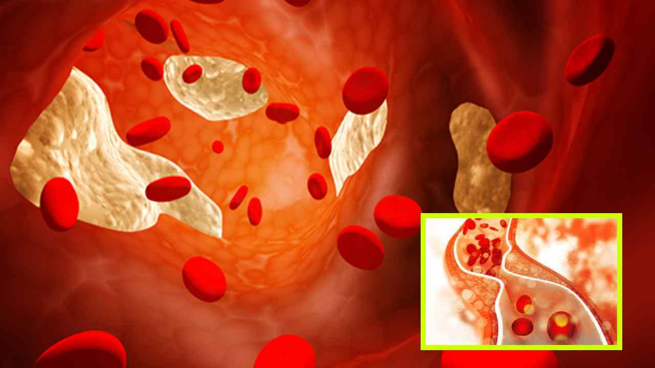High Cholesterol : అధిక కొలెస్ట్రాల్ ప్రమాదాన్ని తగ్గించడంలో సహాయపడే ఆహార కలయికలు ఇవే ?