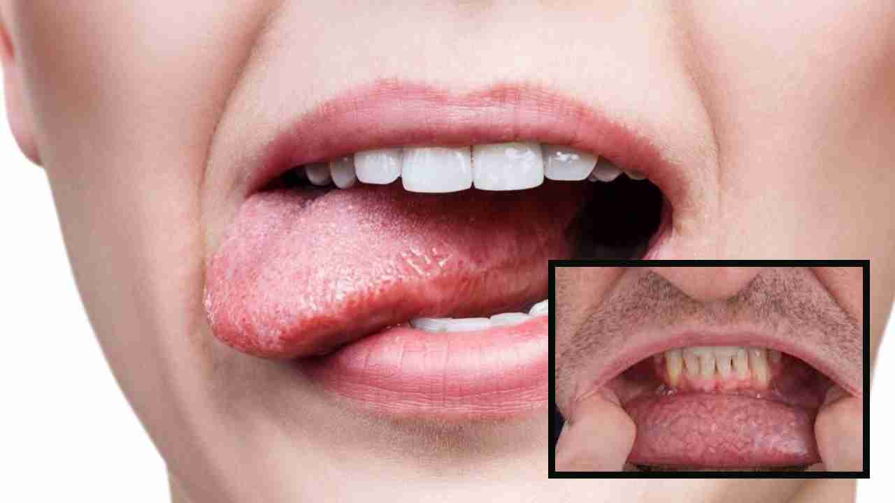 Oral Cancer : నోటి క్యాన్సర్‌కు కారణాలు ? దానిని నివారించడానికి చిట్కాలు !