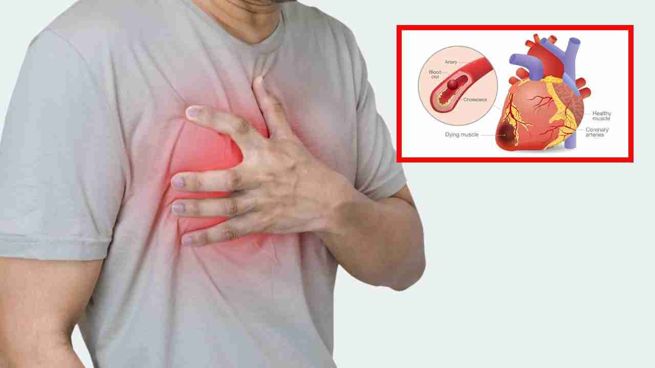 Heart Attack : కార్డియాక్ అరెస్ట్ , గుండెపోటుకు ప్రమాద కారకాలు, లక్షణాలు , నివారణ !