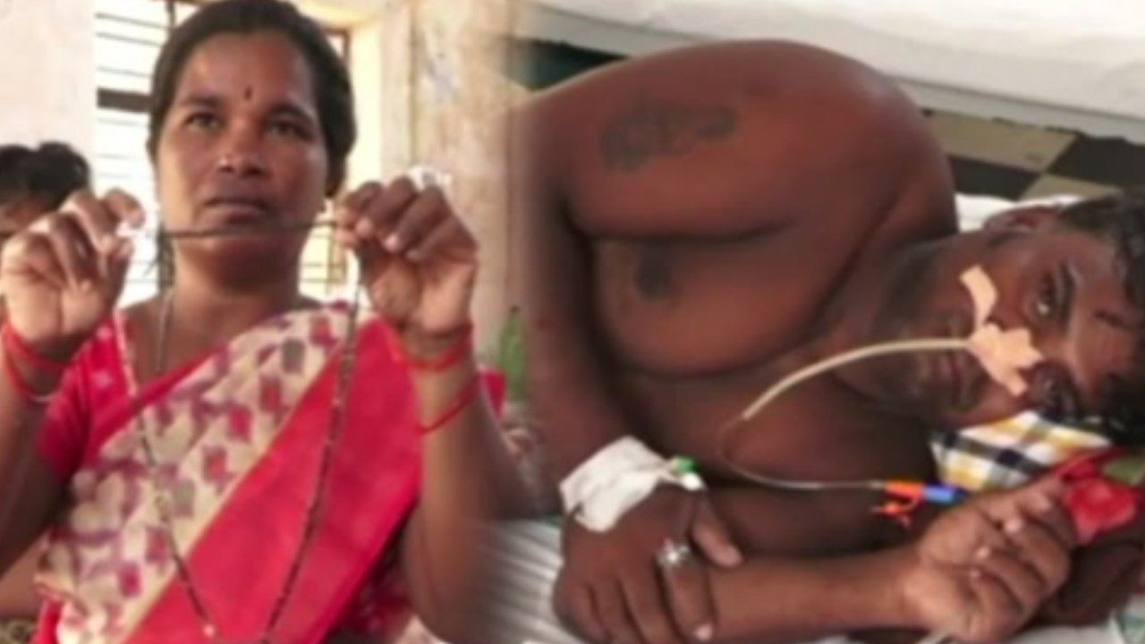 Dharmavaram : భార్య లాంగ్ చైన్ మింగేసిన భర్త.. మూడు నెలలుగా కడుపులోనే.. చివరికి ఏం జరిగిందంటే?