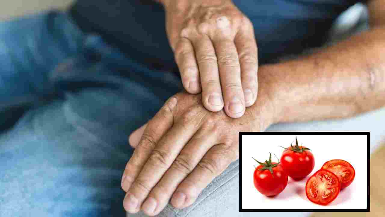 Tomatoes Bad For Arthritis : ఆర్థరైటిస్‌తో బాధపడేవారు ఆహారంలో టమోటాలను తీసుకోకూడదు ఎందుకో తెలుసా ?