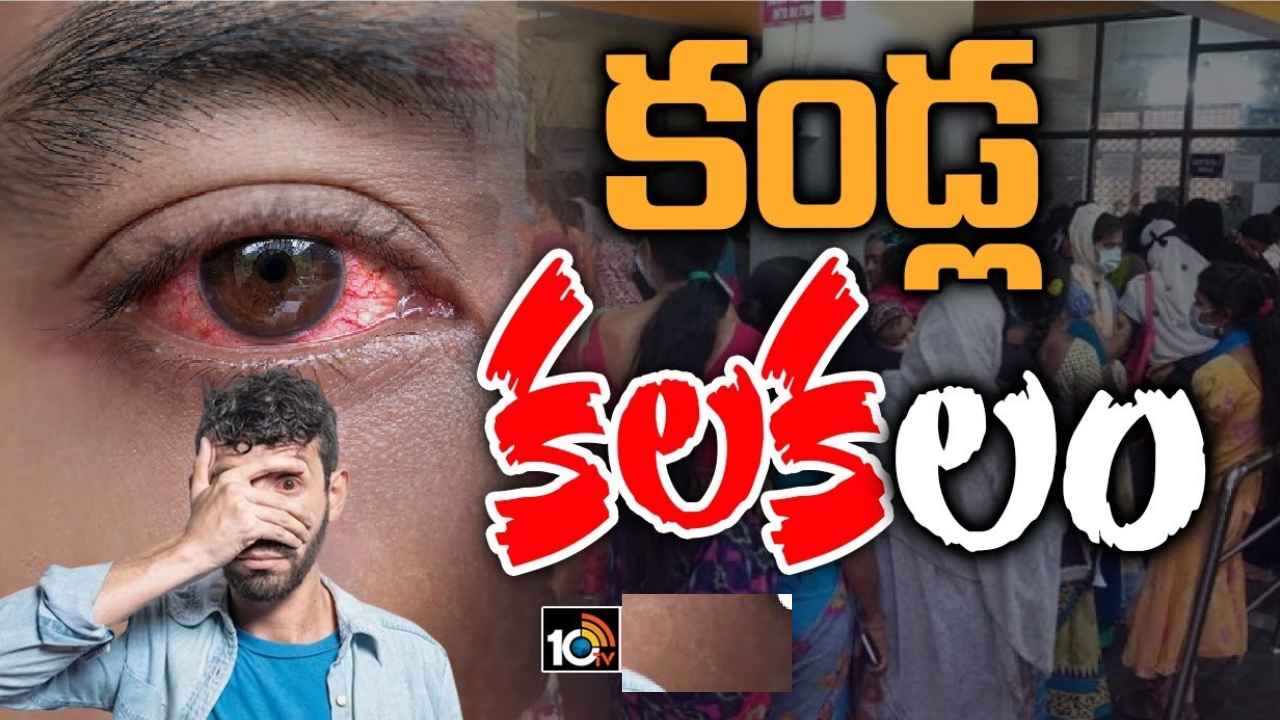 Conjunctivitis : బీకేర్ ఫుల్.. తెలంగాణలో క‌ల‌వ‌ర‌పెడుతున్న క‌ళ్ల క‌ల‌క.. ఆ తప్పు అస్సలు చేయొద్దు, తప్పనిసరిగా తీసుకోవాల్సిన జాగ్రత్తలు