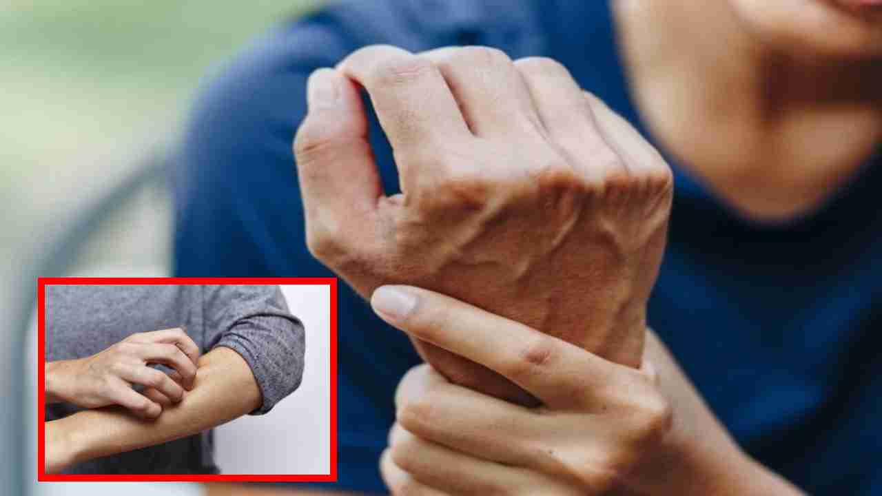 Skin Diseases In Diabetics : మధుమేహ బాధితుల్లో చర్మ వ్యాధులను ప్రేరేపించే వర్షాకాలం.. చర్మ ఆరోగ్యం కోసం అనుసరించాల్సిన విధానాలు !