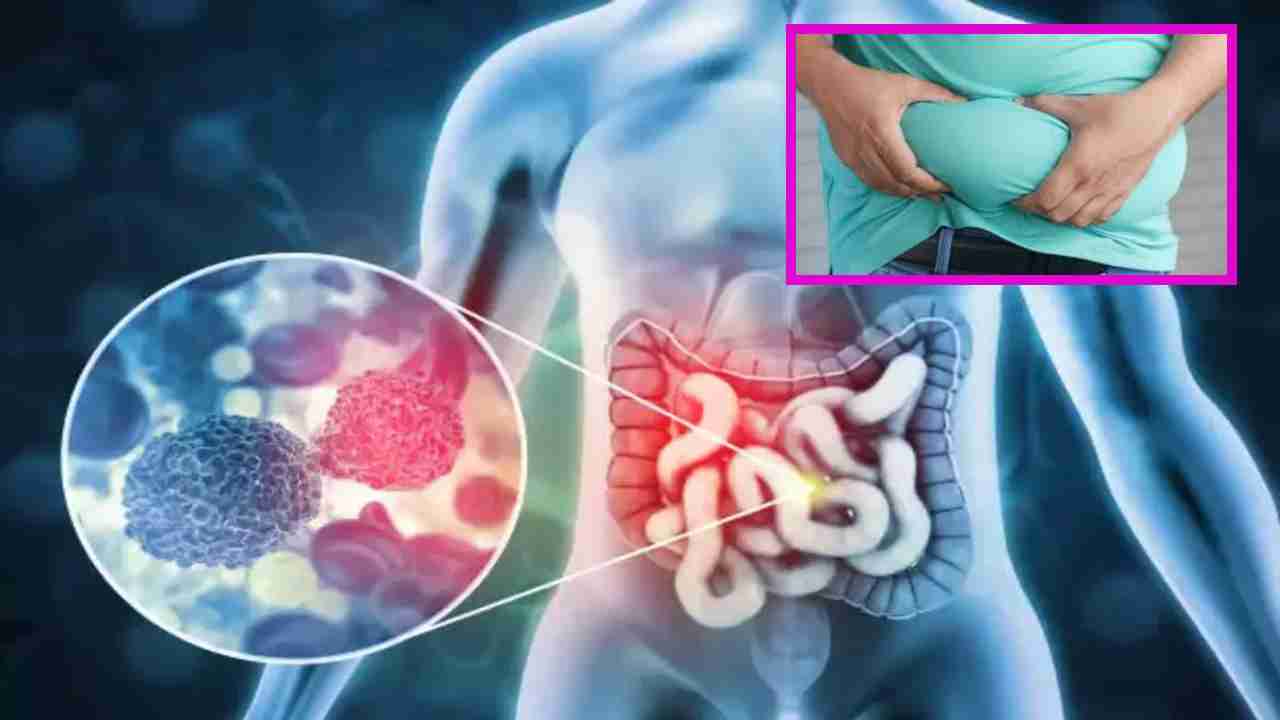 Obesity and Cancer : ఊబకాయంతో క్యాన్సరు వచ్చే ప్రమాదం ఉందా ?