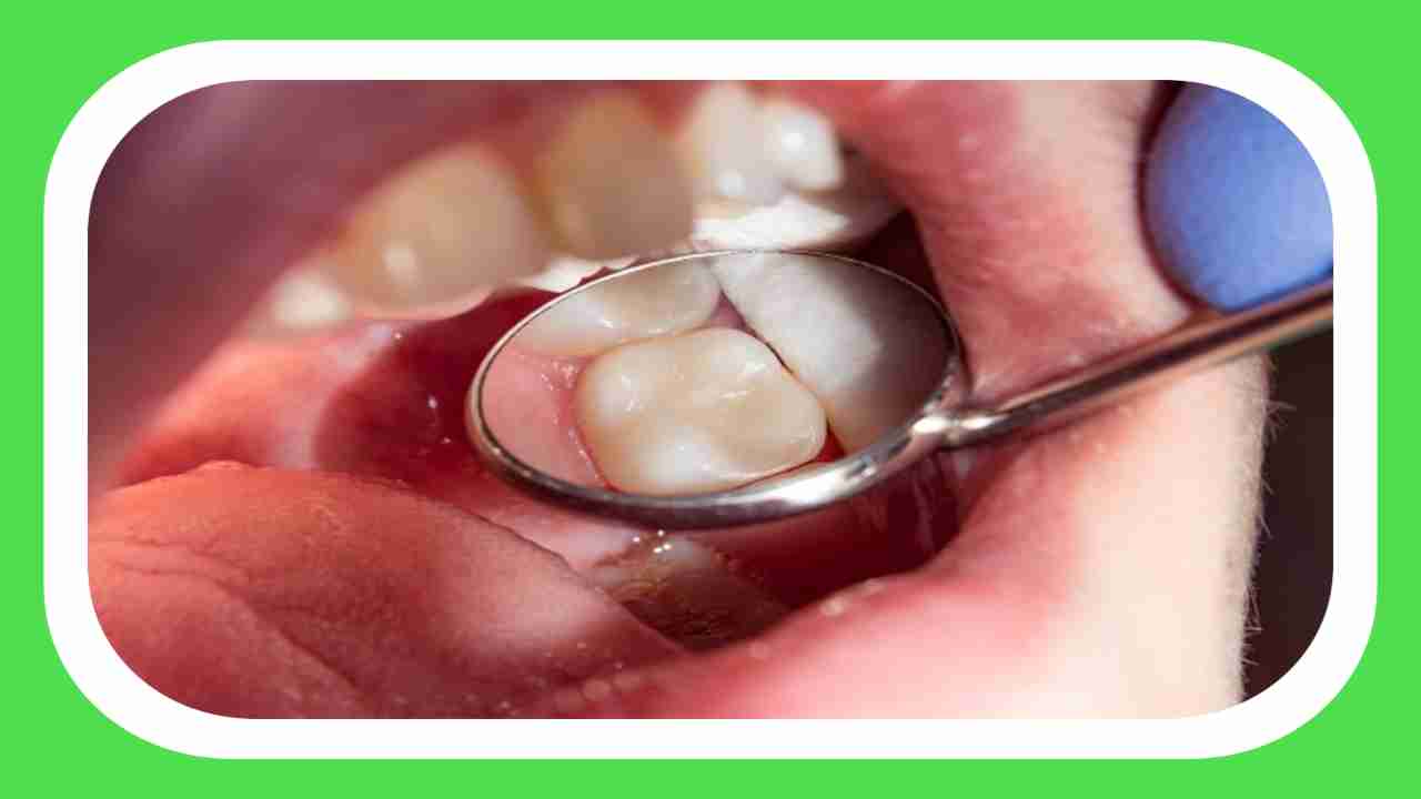 Dental Health : దంత ఆరోగ్యం విషయంలో చాలా మందిలో నెలకొన్న అపోహలు Vs వాస్తవాలు !