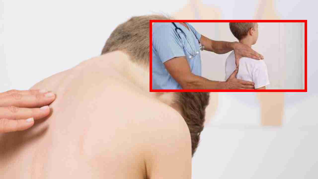Sign of Scoliosis : మీ పిల్లలలో భుజాలు, తుంటి లో అసమానతలు ఉన్నాయా ? ఇది పార్శ్వగూని సంకేతమా?