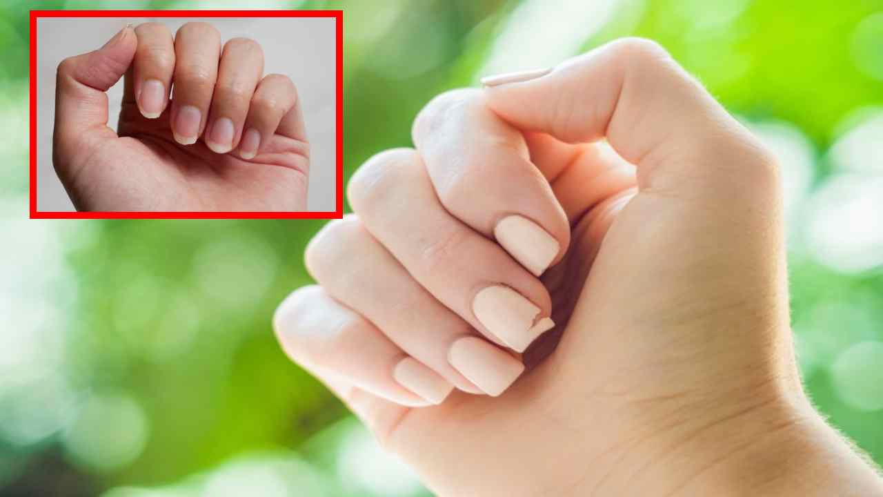 Brittle Nails : గోళ్లు విరుగుతున్నాయా… జాగ్రత్త