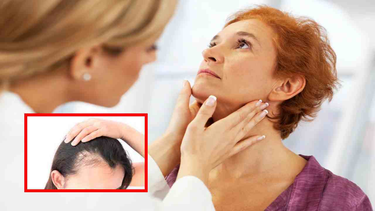 Hypothyroidism : థైరాయిడ్ తగ్గితే జుట్టు పెరుగుతుందా?