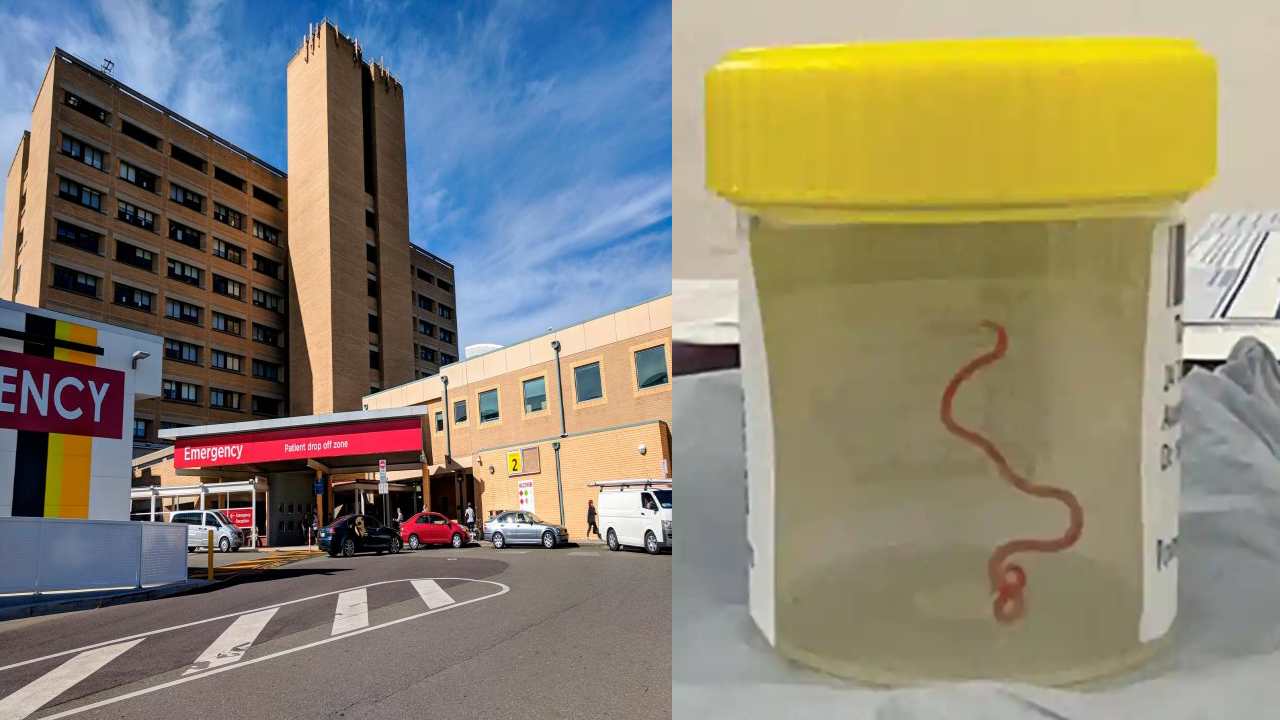 Australia : మహిళ మెదడులో 3 అంగుళాల పారాసైట్.. అరుదైన కేసుగా చెబుతున్న న్యూరో సర్జన్లు