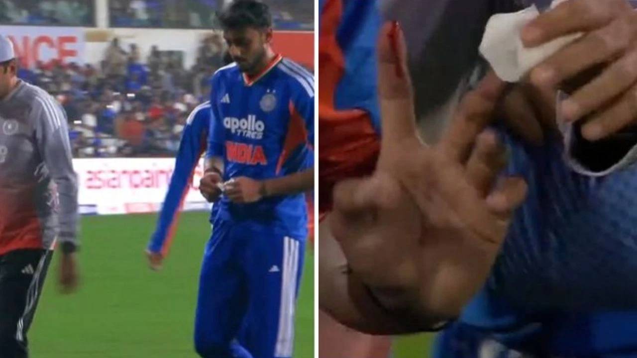 IND vs NZ : టీమిండియాకు బిగ్ షాక్.. మరో ప్లేయర్ ఔట్..? వేలు చిట్లి రక్తస్రావం కావడంతో..